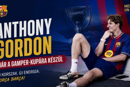 Anthony Gordon mindent megtesz a gyors visszatérésért